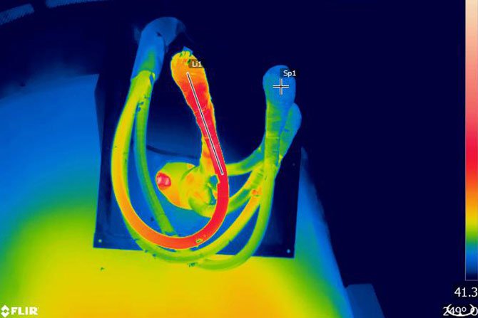 estudios-termograficos